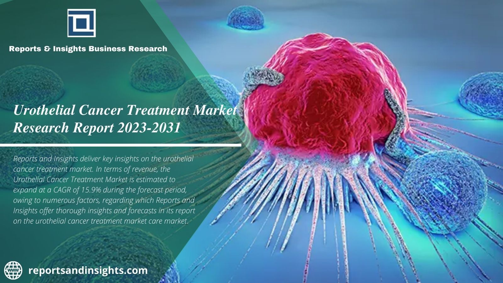 Urothelial Cancer Treatment Market Is Expand at a Cagr of 15.9%.