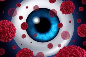 Uveal Melanoma Treatment Market Share & Forecast Report to 2028