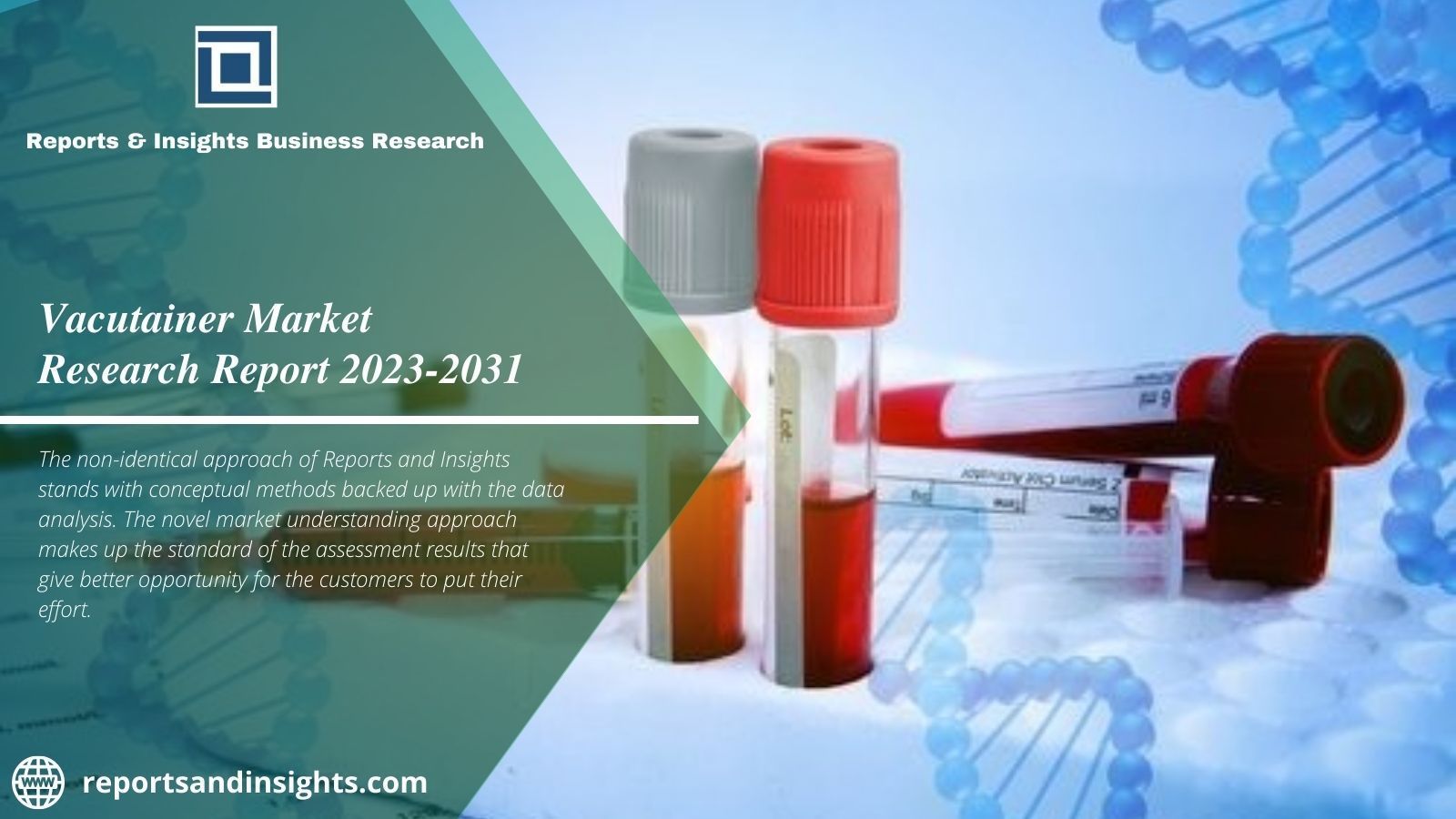 Vacutainer Market Size 2023, Top Vendors Recommended Industry 