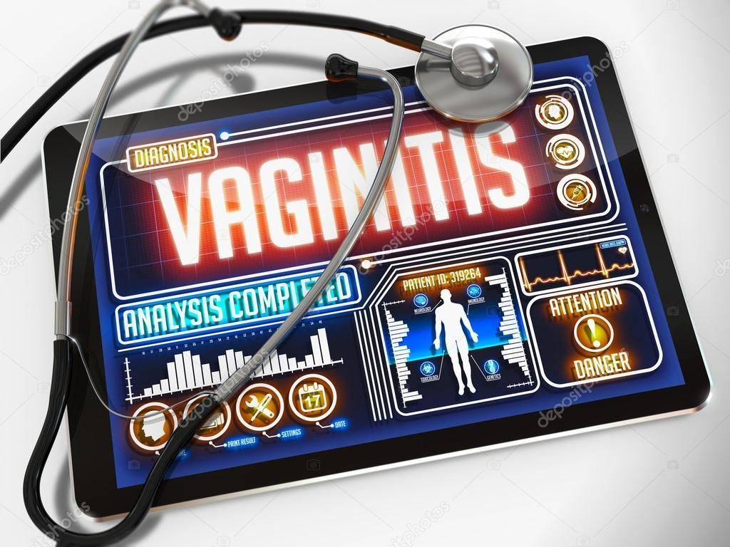 Vaginitis Diagnostics Market Research 2028 Value Market Research