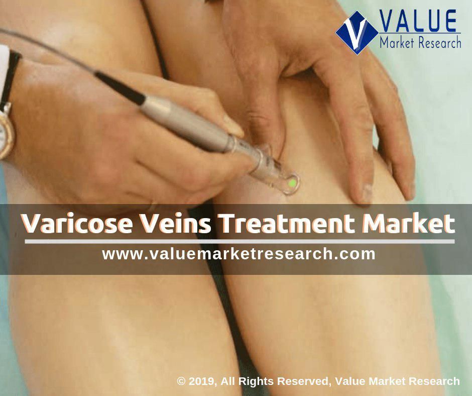 Varicose Veins Treatment Market Share | Research Report, 2028