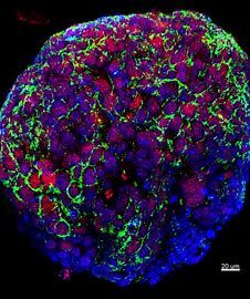 Whole Exome Sequencing Market Analysis New Opportunities by 2028