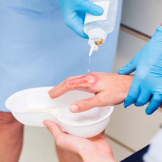 Wound Care Biologics Market 2022 Size & Forecast Report to 2028
