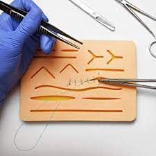 Wound Suture Instrument Kit Market Growth & Forecast Report 

