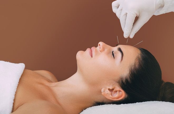 Acupuncture for Neuropathic Pain: How Does It Work?