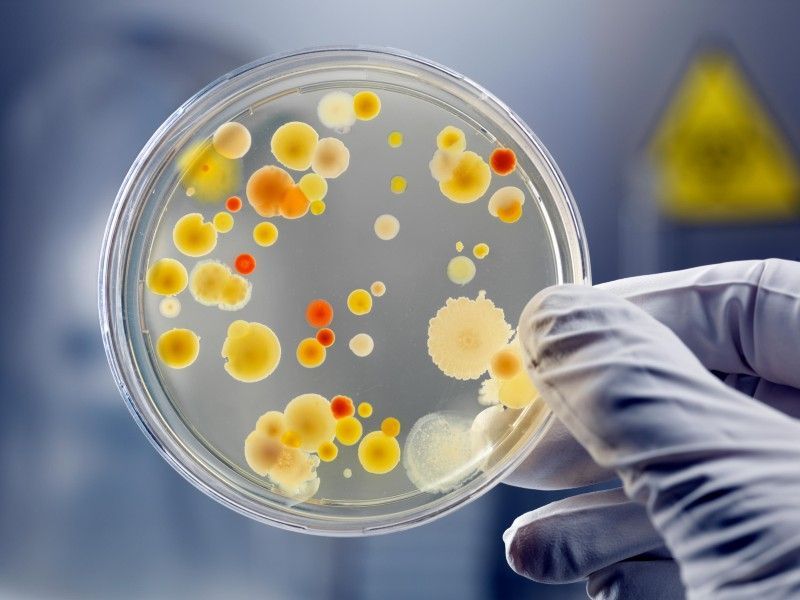 Bacterial Cell Culture Market Size, Key Players Analysis 