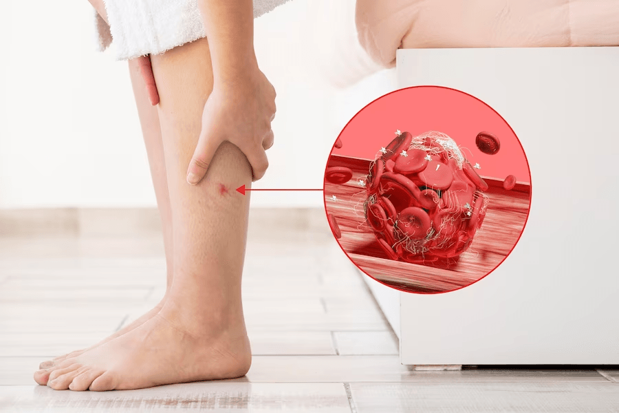 What Techniques Are Used in Modern Leg Vein Treatment?