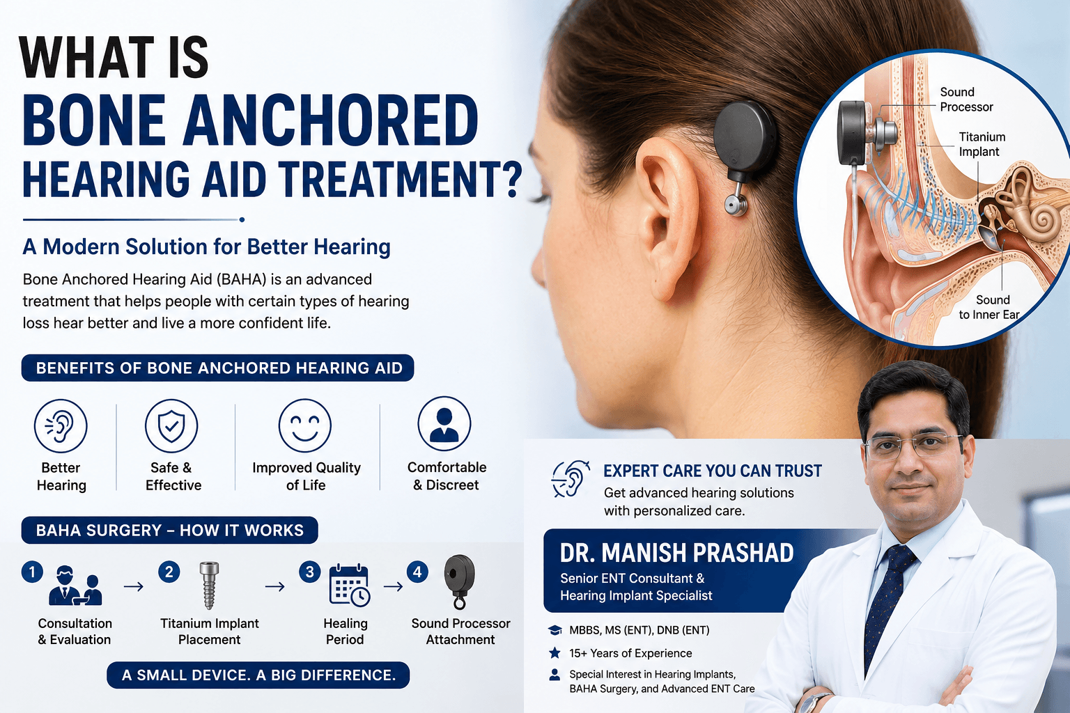bone anchored hearing aid treatment in Gurgaon, BAHA Surgery in Gurgaon, Bone Anchored Hearing Aid Surgery in Gurgaon.