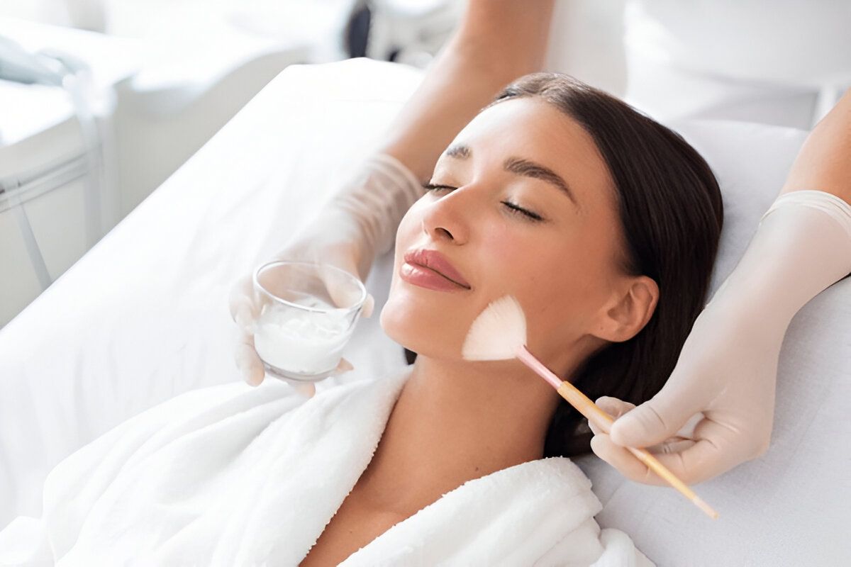 Chemical Peel in Islamabad for Acne Scars, Pigmentation, and Fine Lines