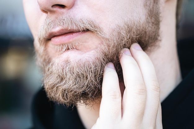 Is a Beard Hair Transplant Possible and What’s Its Cost?