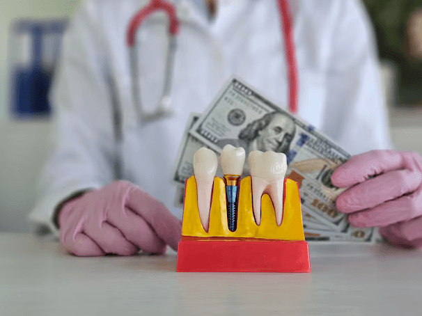 The Cost and Benefits of Dental Implants for Missing Teeth