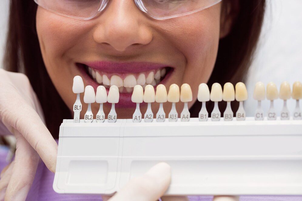 Dental Veneers – Cosmetic Solution That Can Improve the Appearance of Teeth