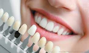 Lifespan of Dental Fillings: Strategies for Long-Lasting Results
