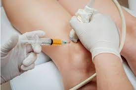 Viscosupplementation Injection Market 2023 Industry Scenario