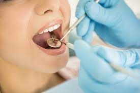 How to Get Your Teeth Clean Before the Dentist