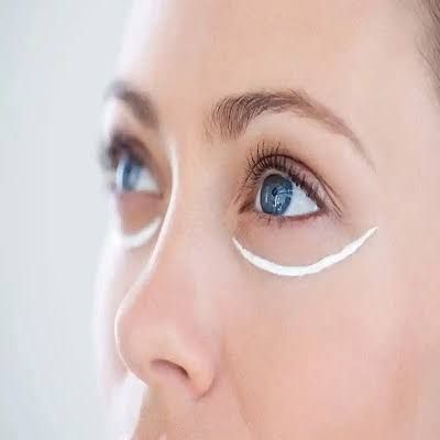 What Is the Purpose of Eye Bag Removal?