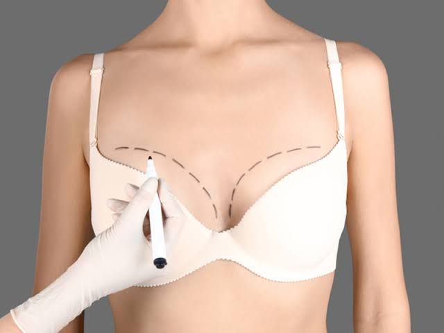 Who Is a Good Candidate for Breast Lift Surgery?