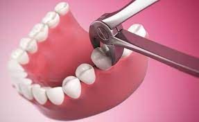 The Benefits of Regular Dental Checkups and Cleanings