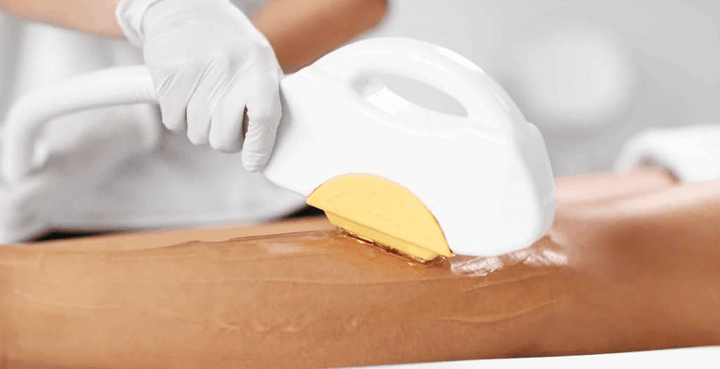 How Do Ipl and Laser Hair Removal Actually Work?