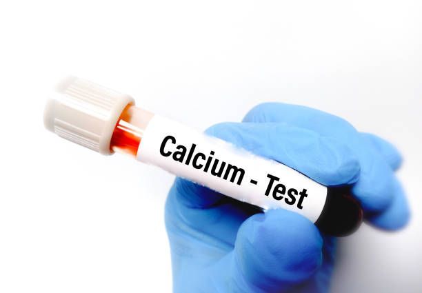 What Is the Importance of a Calcium Test for Health You Must Know