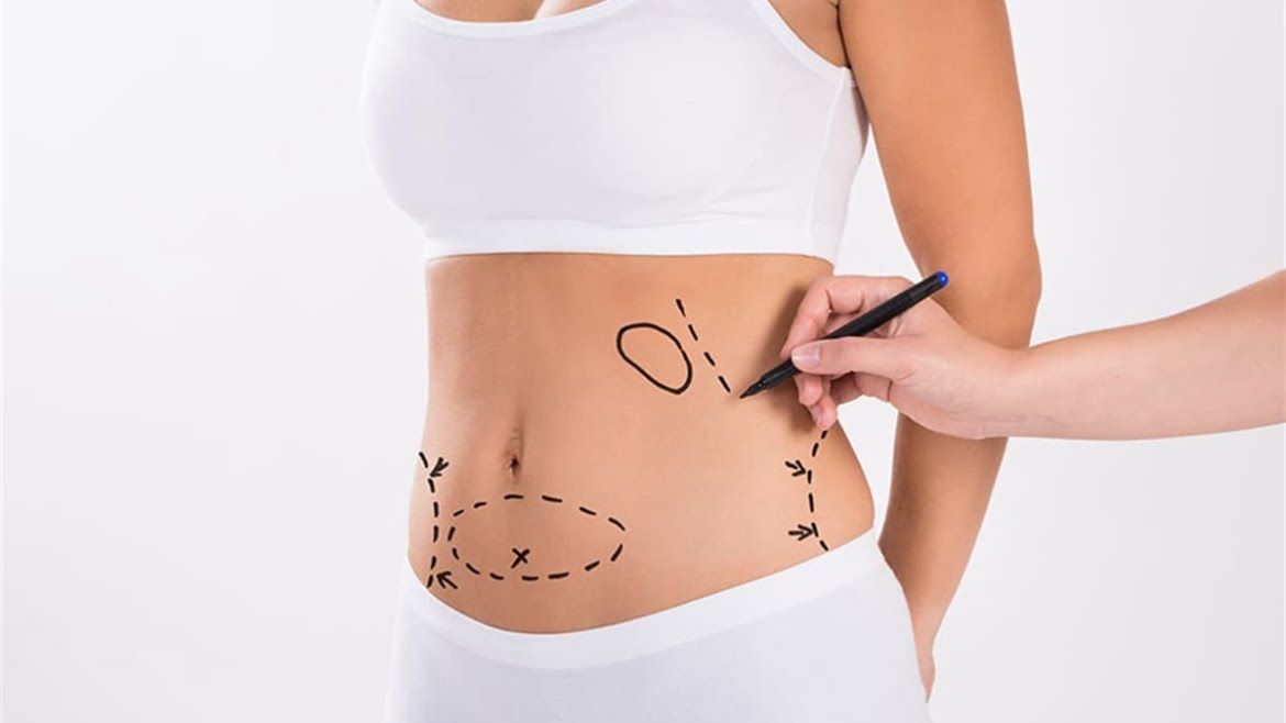What Should You Know About Liposuction in Dubai?