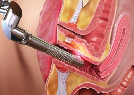 Improve Comfort and Confidence with Modern Vaginal Rejuvenation Treatment