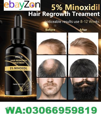 Best minoxidil hair growth serum in pakistan - ebayzon.pk