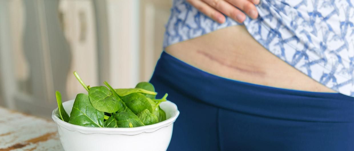 Taking Care of Your Caesarean Scars
