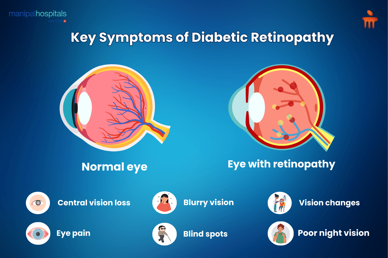 What Causes Diabetic Retinopathy?